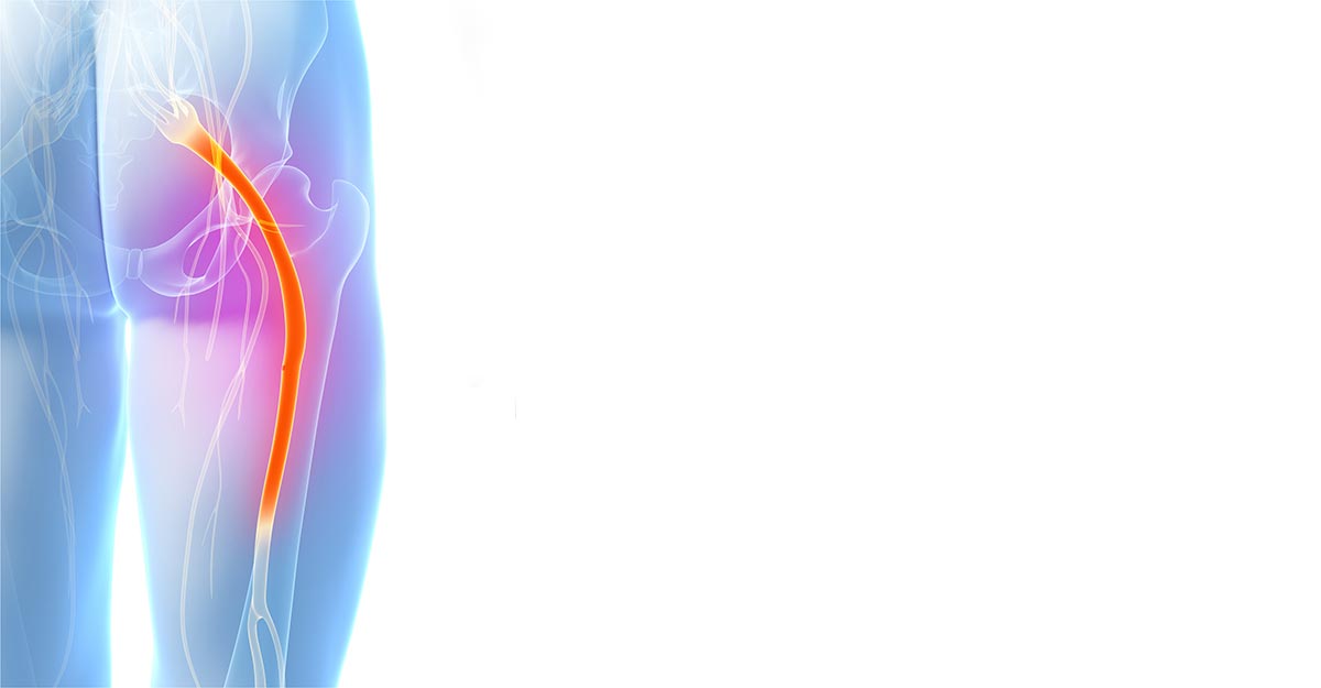 Rockville sciatica treatment and chiropractic