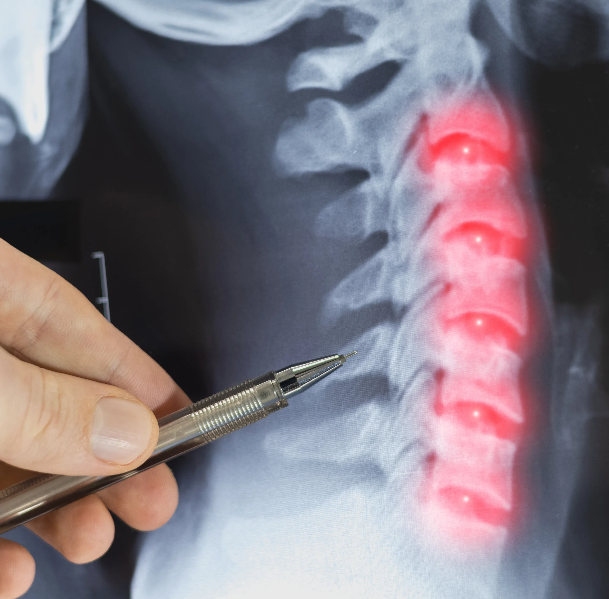 Chiropractic Safely Relieves Neck Pain in Older Adults