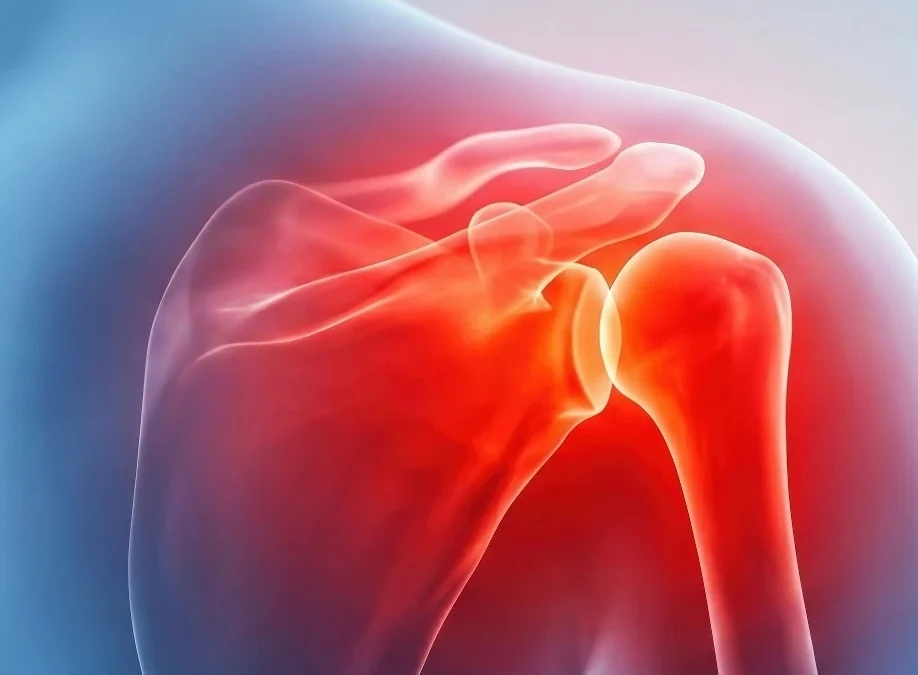 Natural Shoulder Pain Treatment: Drug-Free Relief That Works