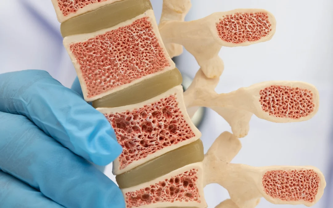 Cervical Disc Herniation: How Chiropractic Can Help