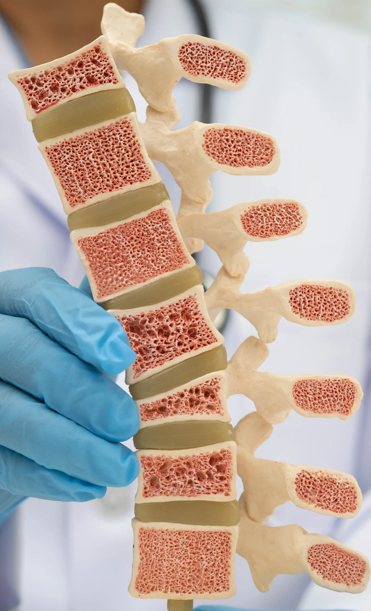 Doctor explaining spine anatomy model to patient